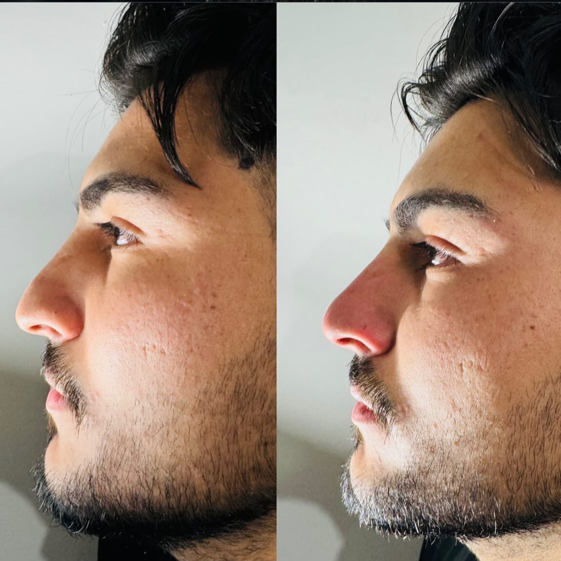 Zarif Dokunuş Kuaför & Güzellik Salonu